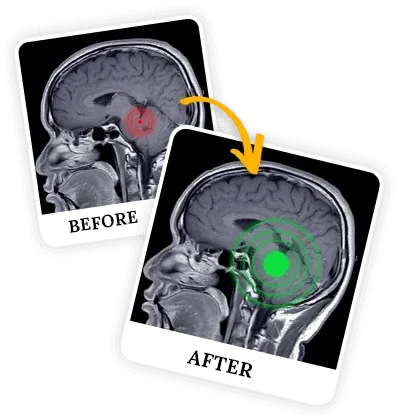 what is The Neuro Wave program